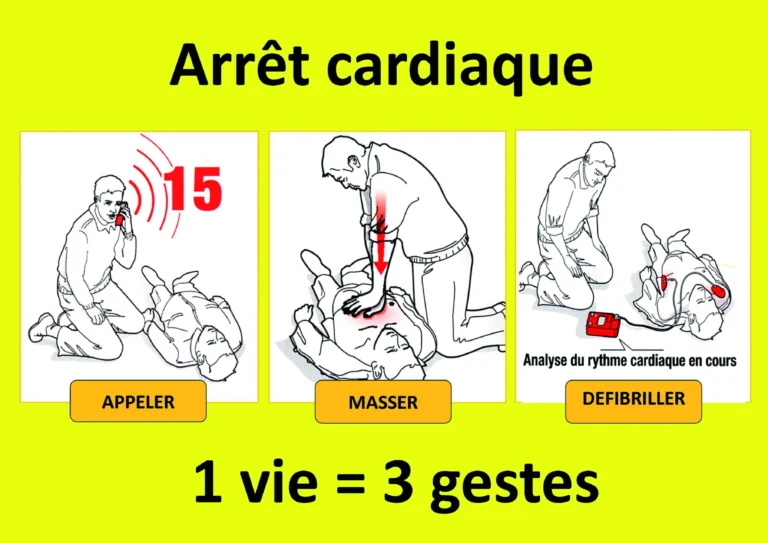 geste arret cardique 2